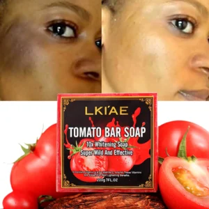 AILKE Organic Tomato Soap Bar, Lighten Skin, Deeply Clean, Exfoliate, Remove Black Spots, Moisturizing, With Rich Foam Body Wash